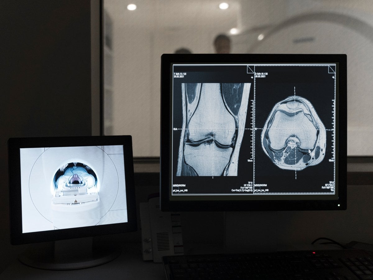 Bild på röntgenbilder som analyseras på dator