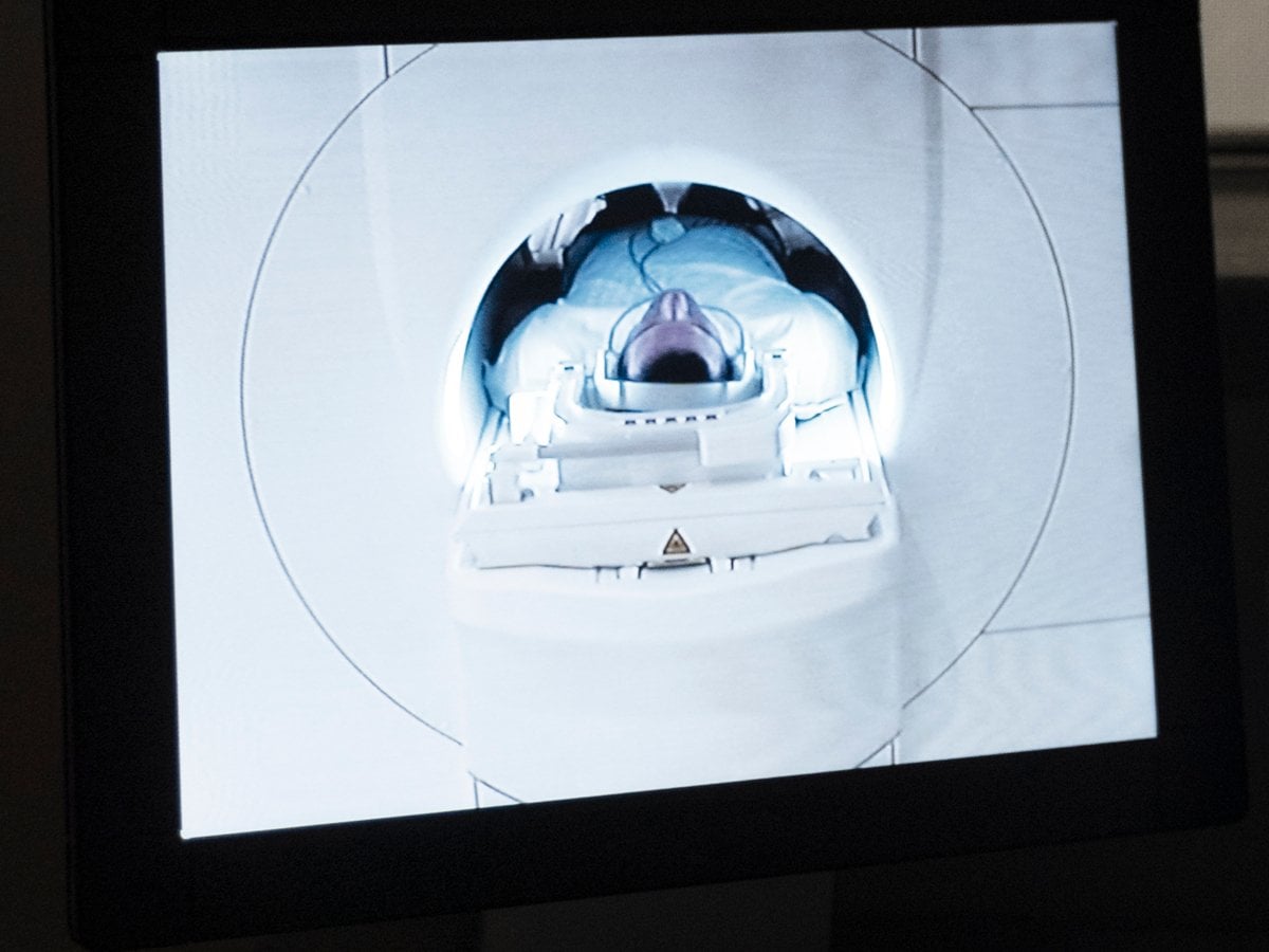 Bild på röntgenbilder som analyseras på dator